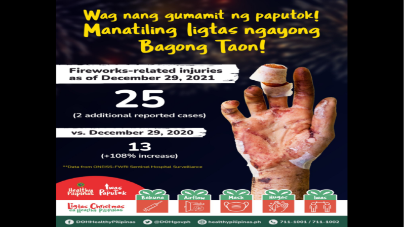 DOH nakapagtala na ng 25 na fireworks-related injuries