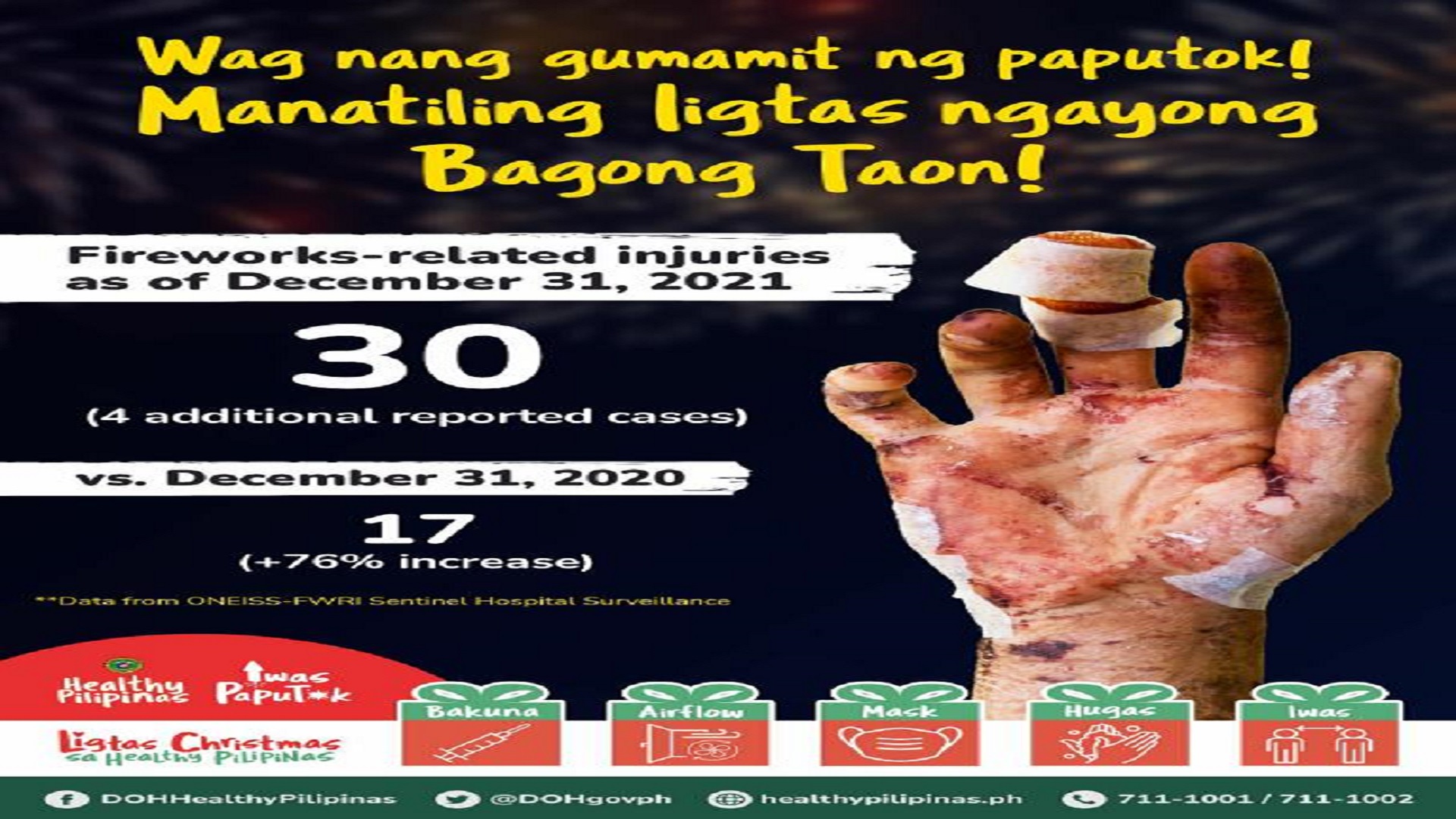 DOH nakapagtala na ng 30 fireworks-related injuries