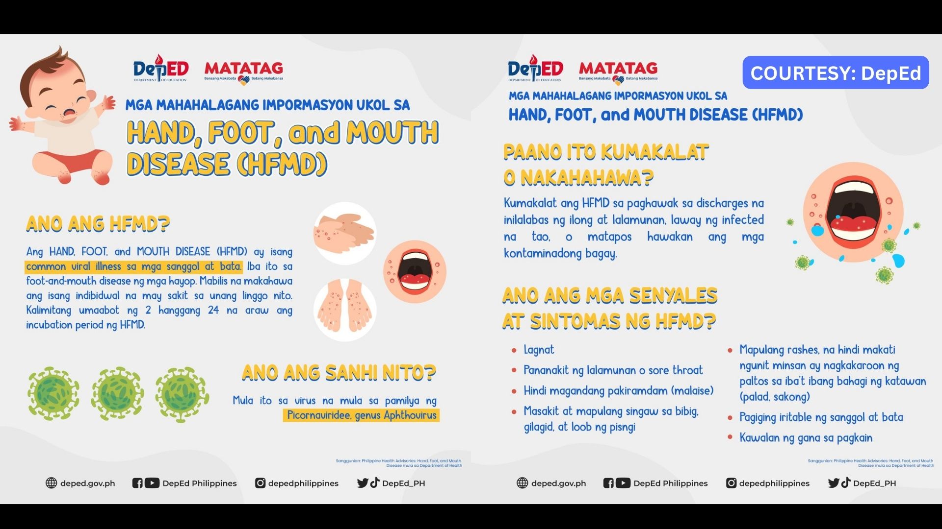 DepEd nagpaalala hinggil sa Hand, Foot, and Mouth Disease