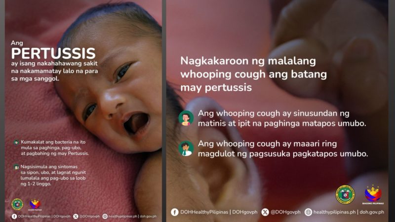 DOH nakapagtala ng 453 cases ng Pertussis o Whooping Cough sa unang 10 linggo ng kasalukuyang taon