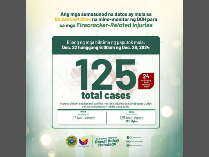 DOH nakapagtala na ng 125 na kaso ng Fireworks Related Injuries