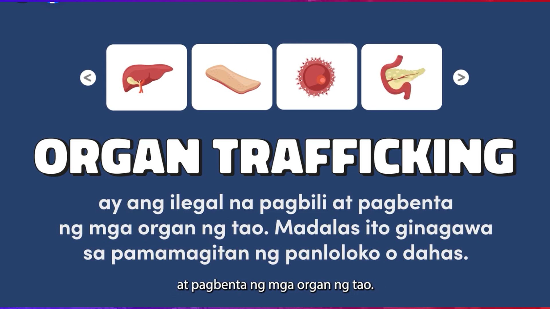 DOH nagbabala sa ilegal na pagbebenta ng kidney