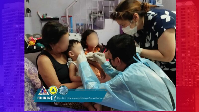 Clustering ng kaso ng HFMD naitala sa isang paaralan sa Quezon City