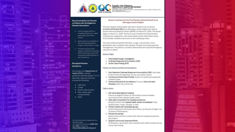 Sanggol sa QC pumanaw sa tigdas